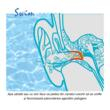 Dopuri de urechi pentru inot, impiedica patrunderea apei in urechi la copii, 1 an+, reutilizabile, hipoalergenice, albastre, SANOHRA Swim Kids [6]