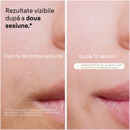 Epilator IPL Braun Silk-expert PRO 5 PL5146 Senzor automat & continuu Skin pro 2.0, 400.000 impulsuri, 10 niveluri de intensitate, 125 de impulsuri pe minut, Cap de precizie, Trusa de voiaj, Aparat de [6]