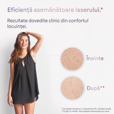 Epilator IPL Braun Skin iExpert PRO 7 PL7253 Tehnologie Skin iExpert, Feedback in timp real, 400.000 impulsuri, 10 niveluri de intensitate, 125 de impulsuri pe minut, Cap de precizie, Cap lat, Trusa d [3]