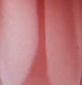 img-attr