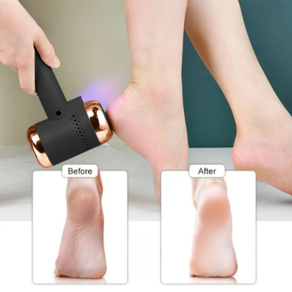 Pila Electrica Pentru Talpi si Calcaie CLAUSTEEL, Acumulator 2400 mAh Quick Charge, Lumina LED, 4 Capete de Slefuit, Sistem de Vacuum Incorporat, Dezinfectare cu Lumina Violeta, Incarcare USB [5]