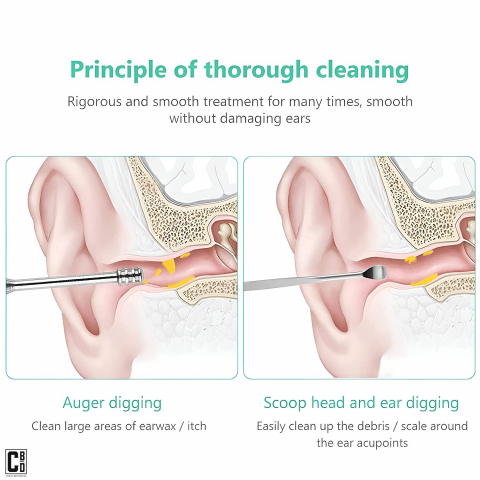 Set 6 Piese pentru Curatarea, Ingrijirea si Igiena Urechilor, din Otel Dermatologic, Gri, Cbd Coral Best Deals [5]