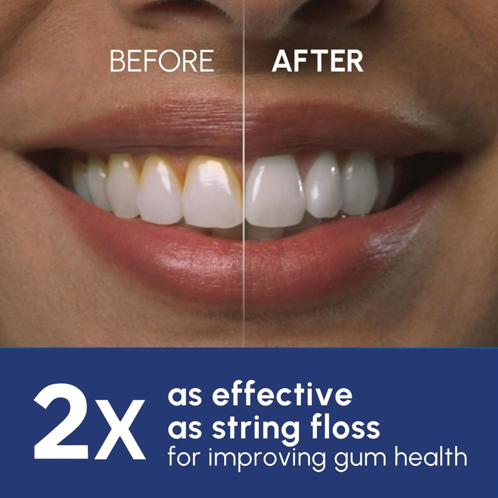 irigator-bucal-waterpik-profesional-aquarius-wp-660-alb-947656.jpg [8]