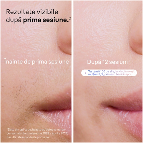 Epilator IPL Braun Skin iExpert PRO 7 PL7253 Tehnologie Skin iExpert, Roz [5]