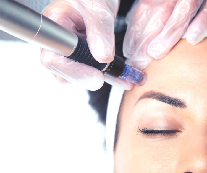 Curs Microneedling [2]