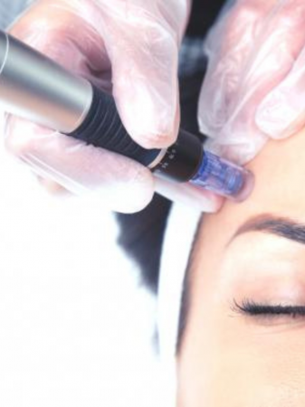 CURSURI SPECIALIZARE - Curs Microneedling