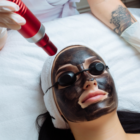 CURSURI SPECIALIZARE - curs peeling carbon