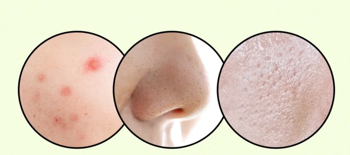 Ulei de curățare a tenului Ariul Apple Cider Deep Cleansing pentru pori, machiaj, sebum și puncte negre, 200ml [3]