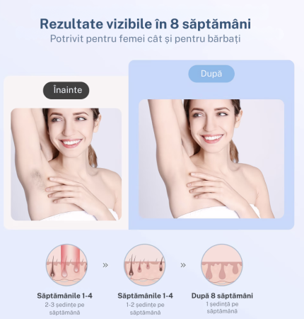 Epilator IPL eGROW® PRO SOFT SKIN, Pentru epilare definitiva fara durere, Tehnologie IPL, 9 Trepte de intensitate, 999.999 impulsuri, 3 Moduri de utilizare, Pentru femei si barbati, fata, corp, axila, [5]