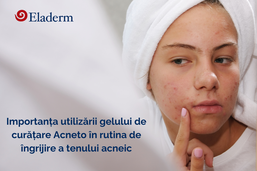 Curățarea tenului acneic. Descoperă gelul de curățare Acneto
