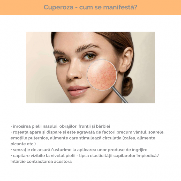 Crema anticuperozica CUPERIX 50 ML [2]
