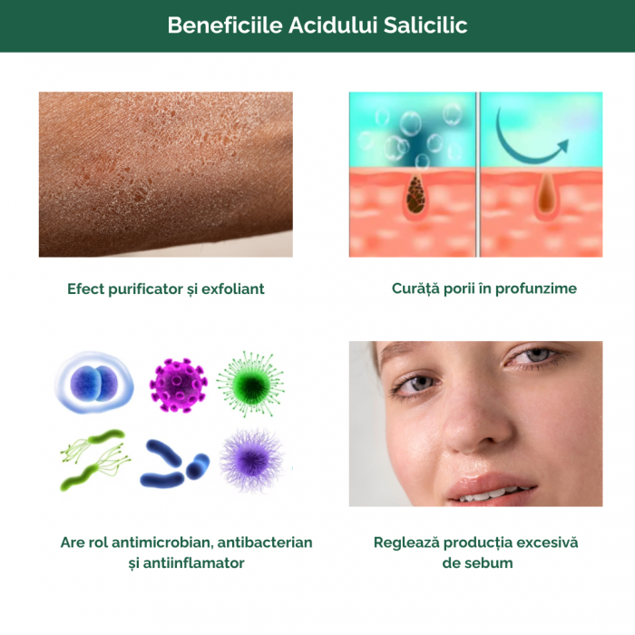 Crema hidratant-exfolianta cu 30% Uree si 2% Acid Salicilic 100ml [4]