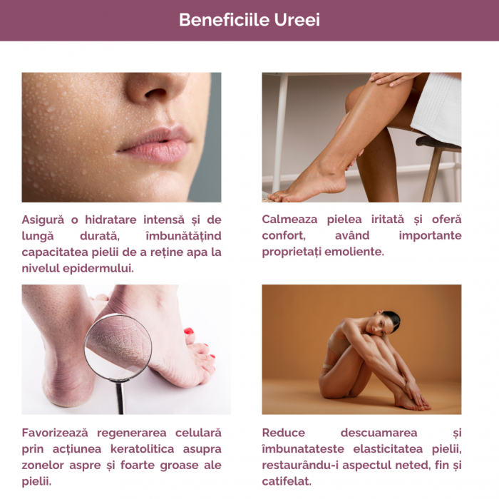 Crema hidratant-exfolianta cu 30% Uree si 2% Acid Salicilic 100ml [5]