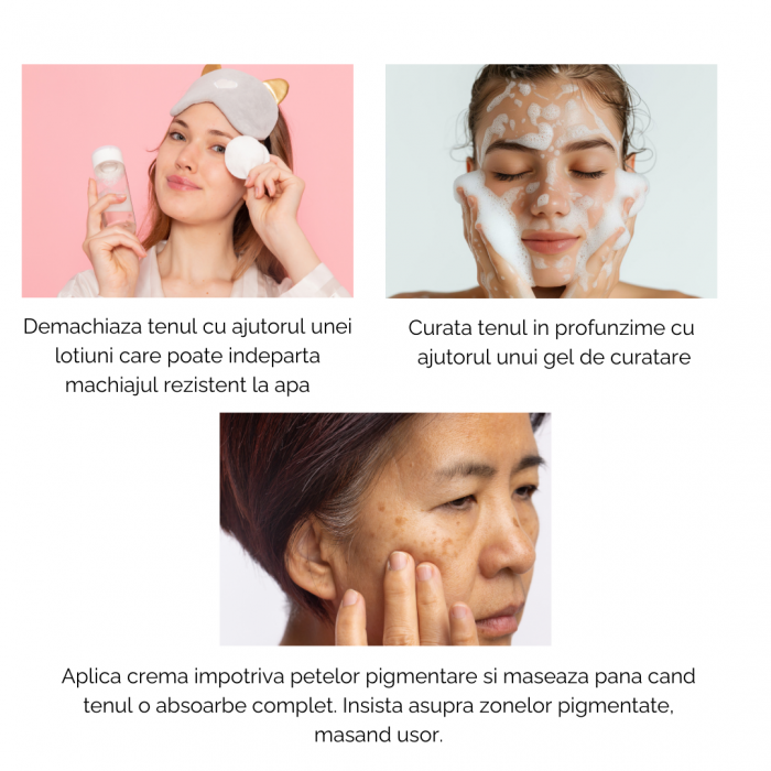 Crema impotriva petelor pigmentare 50ml [8]