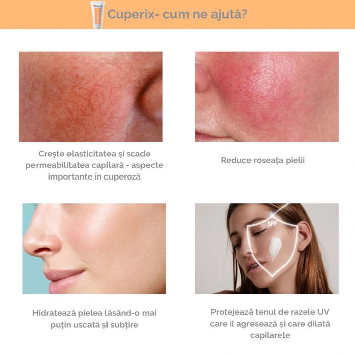 Pachet anticuperoza Cuperix +C [4]