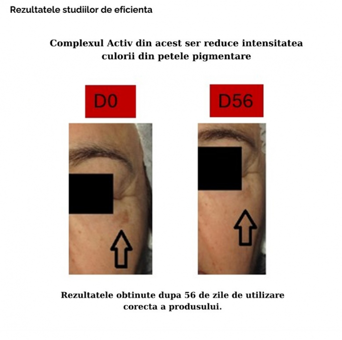 Ser facial pentru stralucire si corectarea petelor pigmentare 30ml [7]