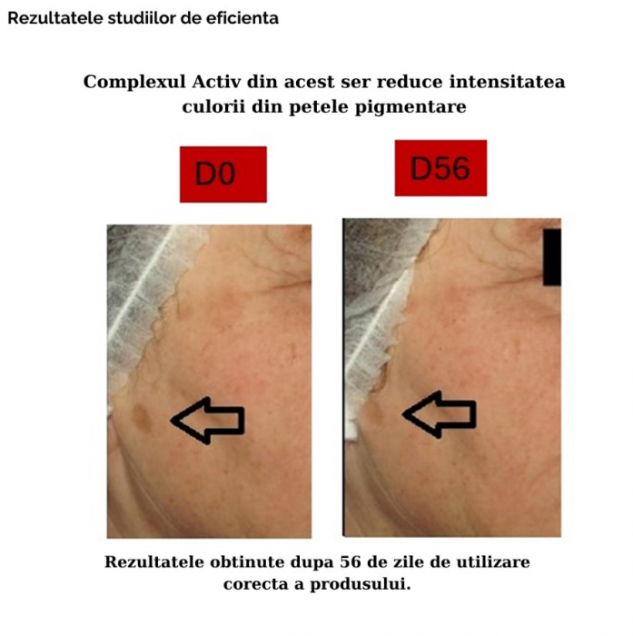 Ser facial pentru stralucire si corectarea petelor pigmentare 30ml [8]