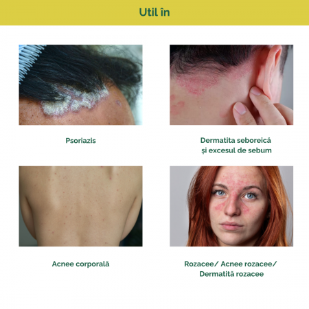 Crema cu 2% Biosulf 100ml [4]