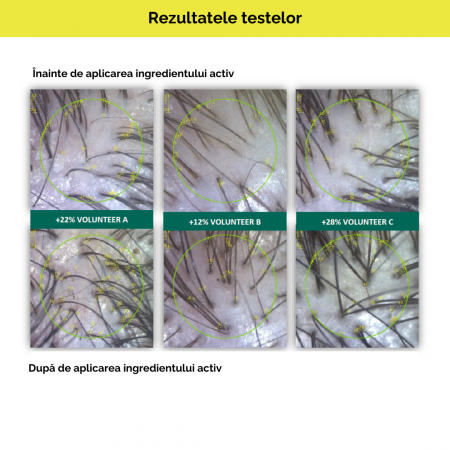 Pachet promotional anticadere Capilforte 2+1 GRATIS [5]