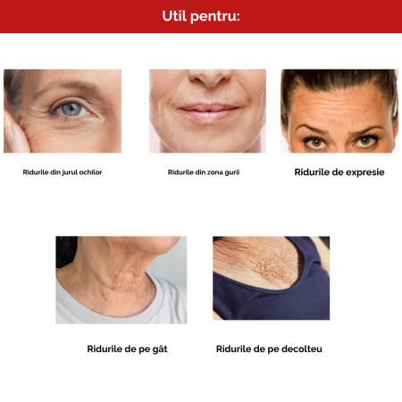 Rid Stop Ultra crema intensiva antirid, 50 ML [3]