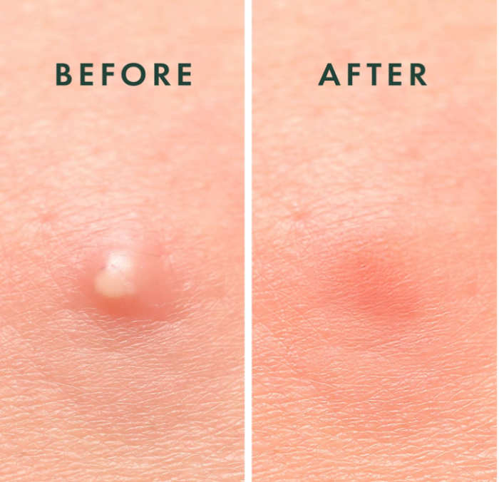 Plasture pentru cosuri Rael, 96 bucati [7]