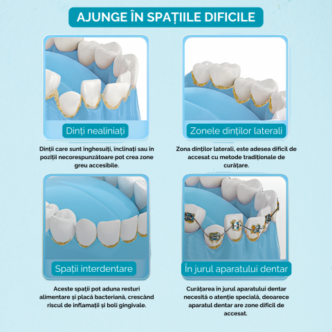 Irigator oral profesional pentru dus bucal, 350ml, electric cu 6 capete, 5 moduri de curatare, jet puternic, design ergonomic, rezistent la apa, portabil si reincarcabil, USB, alb [5]