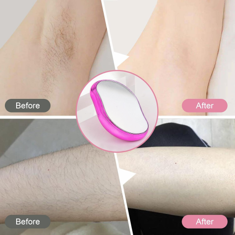 epilator cu cristale altex epilator cu cristale dm epilator fara durere epilator nano cristale dispozitiv epilare cu cristale ieftin epilator fara durere emag [20]