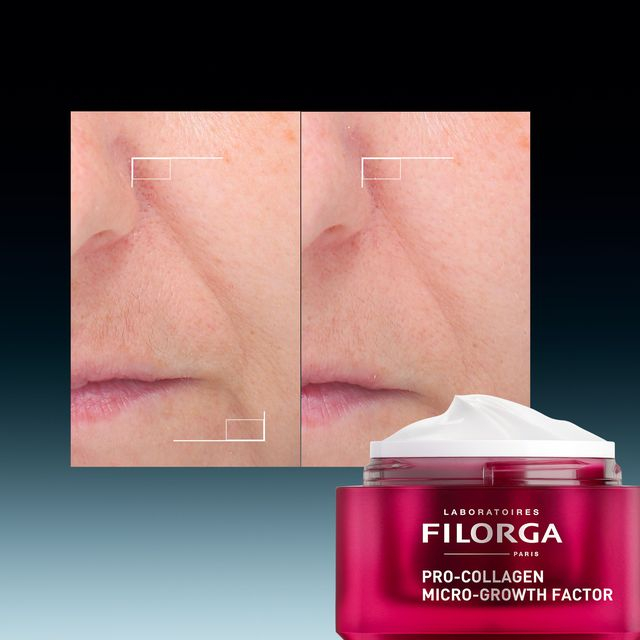 Crema cu efect de lifting si fermitate PRO-COLLAGEN, 50ml, FILORGA [5]