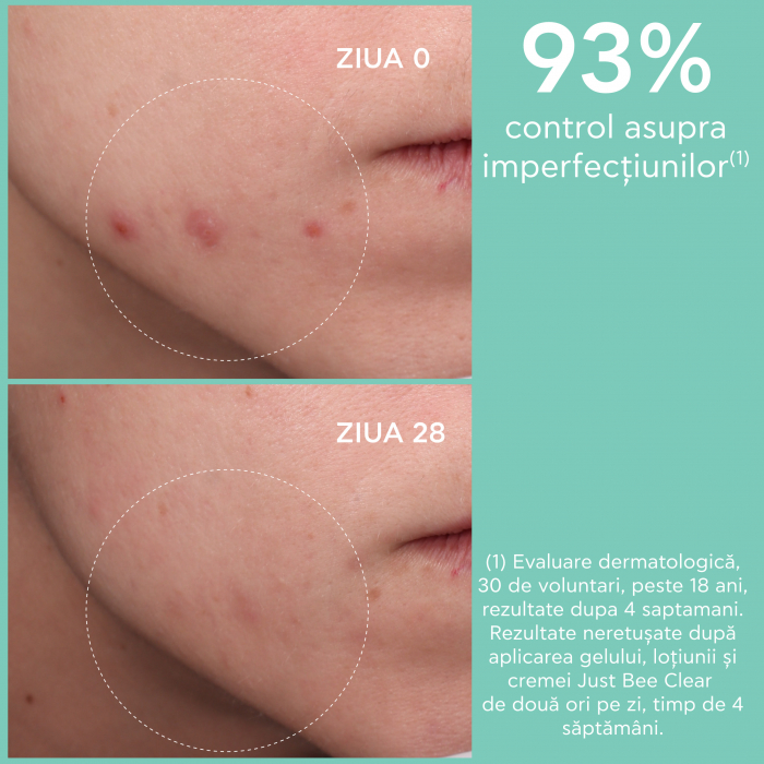 Crema matifianta anti-acnee JUST BEE CLEAR cu 5% niacinamide, 40ml, Apivita [2]