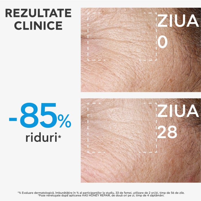 Ser reparator cu Acid Hialuronic, BEE TECH HA5, 30 ml, Apivita [6]