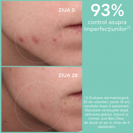 Crema matifianta anti-acnee JUST BEE CLEAR cu 5% niacinamide, 40ml, Apivita [1]
