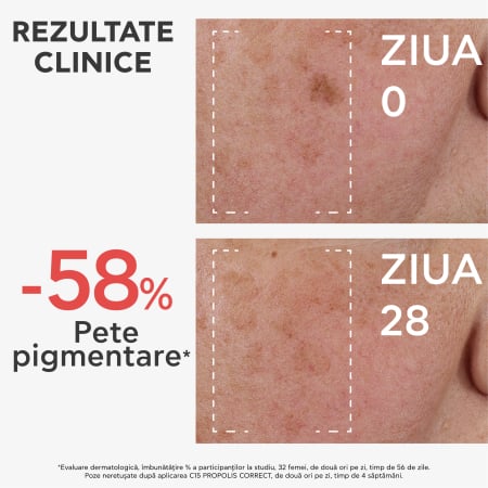 Ser corector antirid cu vitamina C, BEE TECH C15, 30 ml, Apivita [3]
