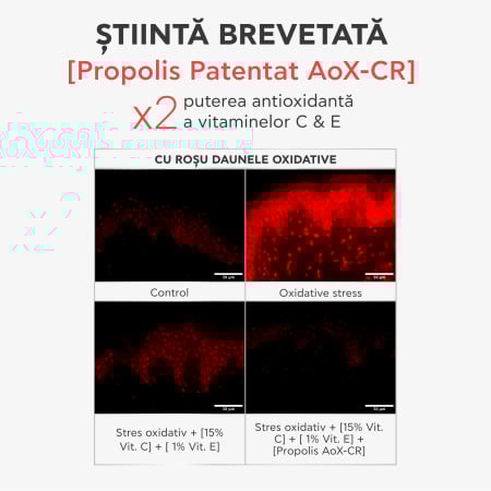 Ser corector antirid cu vitamina C, BEE TECH C15, 30 ml, Apivita [2]