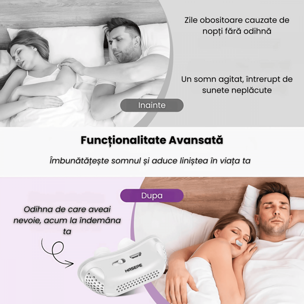 Dispozitiv Inteligent Anti-Sforait HASEPE, Prevenire automata a Sforaitul si Regleaza Tulburarile Respiratorii pentru un Somn Linistit, Viteza reglabila, Pentru toate tipurile de nas, Incarcare USB [5]
