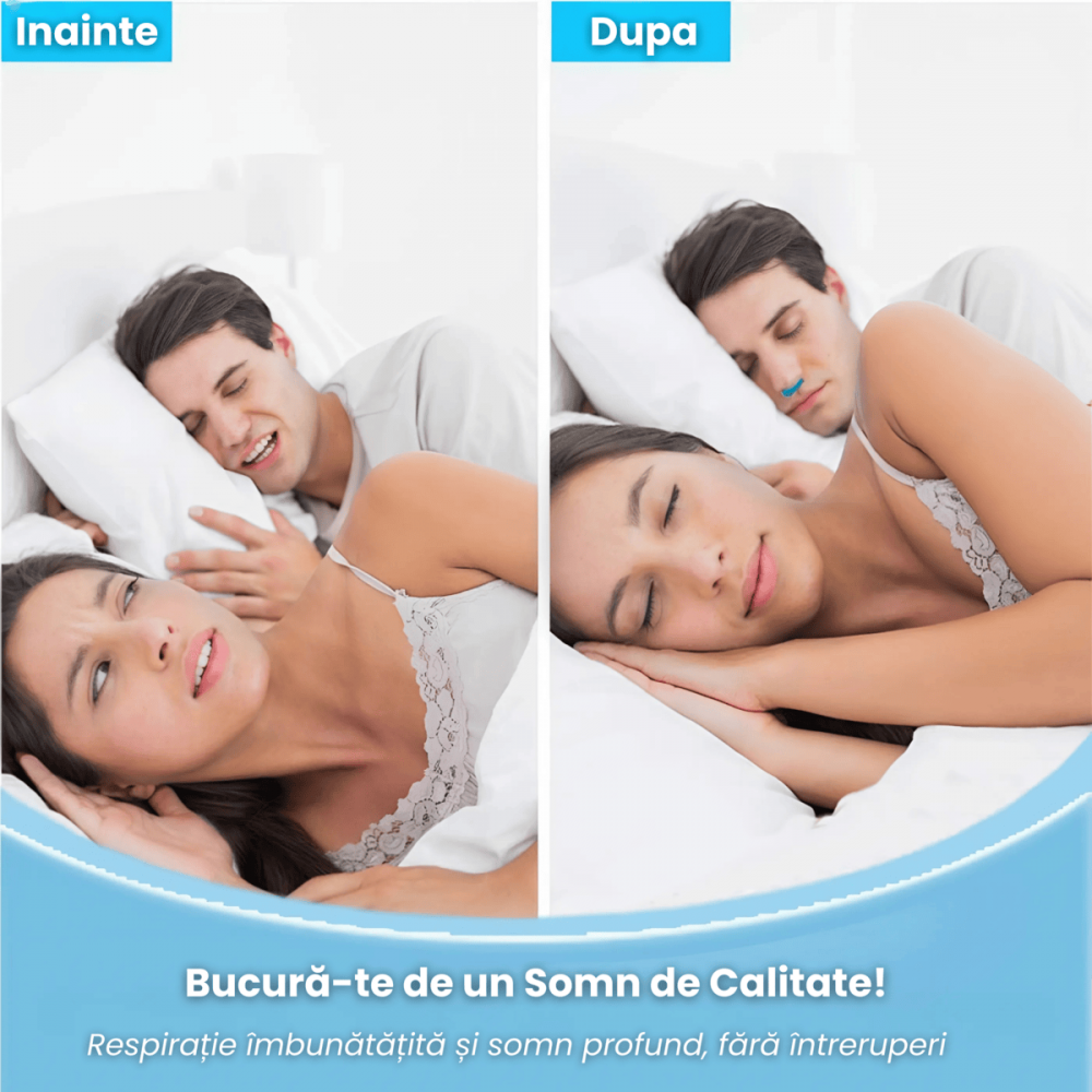 Dispozitiv Anti Sforait HASEPE, Moale si Confortabil, Usor de Utilizat si Curatat, Pentru Barbati si Femei, Imbunatateste Respiratia si Calitatea Somnului, Albastru [6]