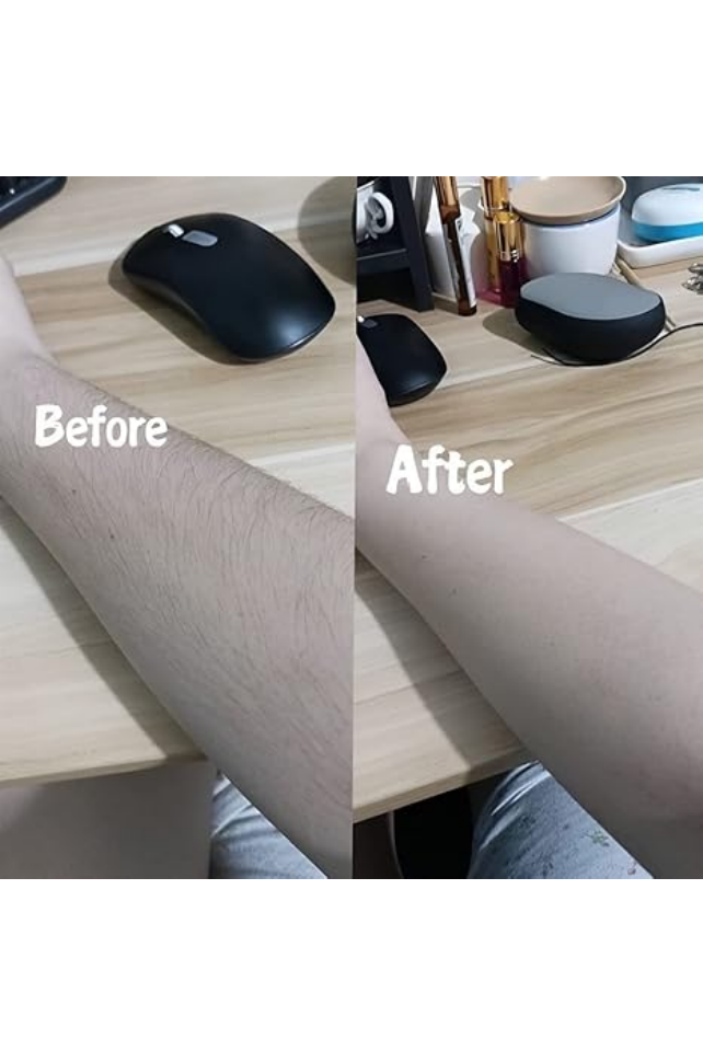 Dispozitiv de Epilare și Exfoliere, Fără Durere, Reutilizabil, culoare Aurie [5]