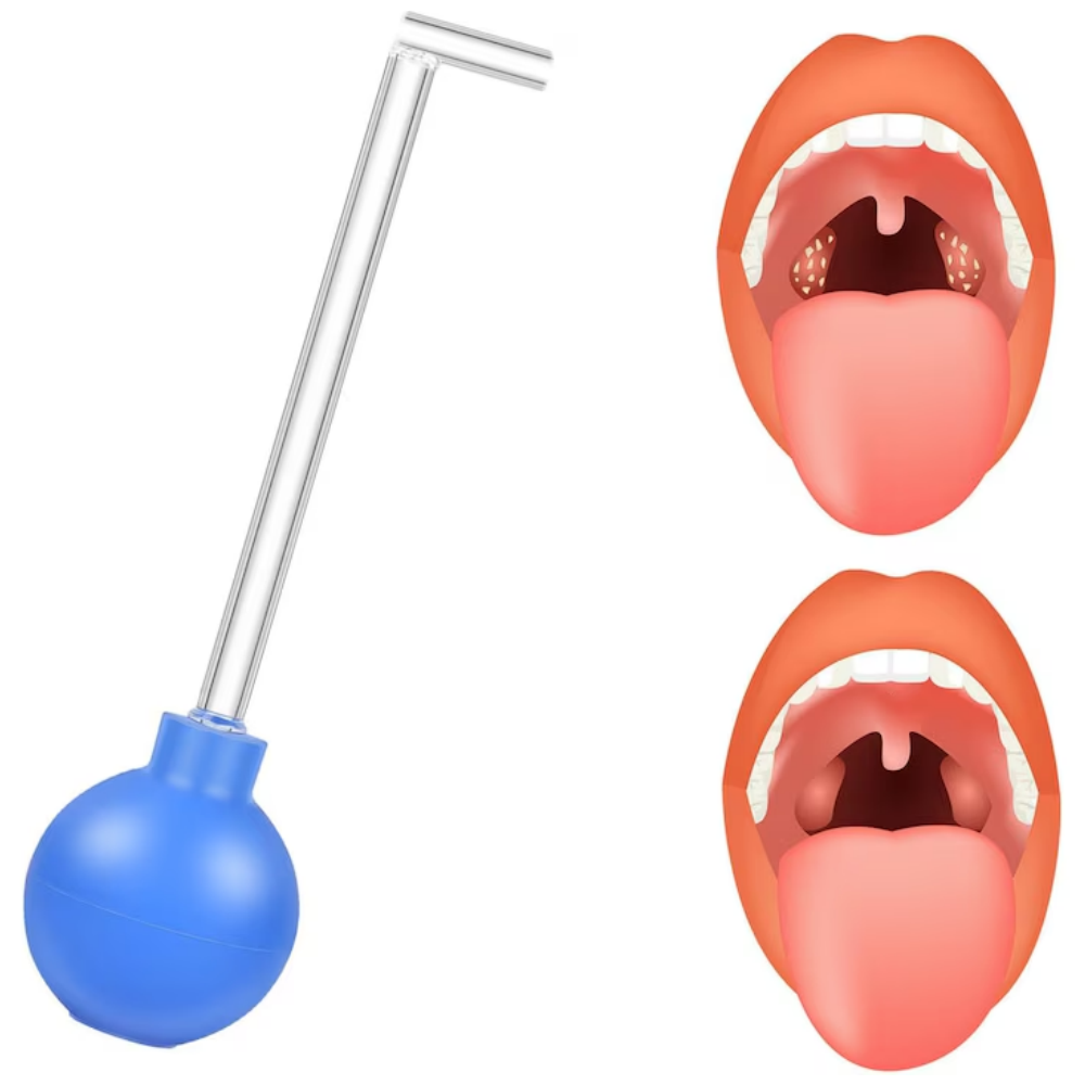 Kit de indepartare a pietrelor de amigdala, design unghiular, PVC, 140mm [4]