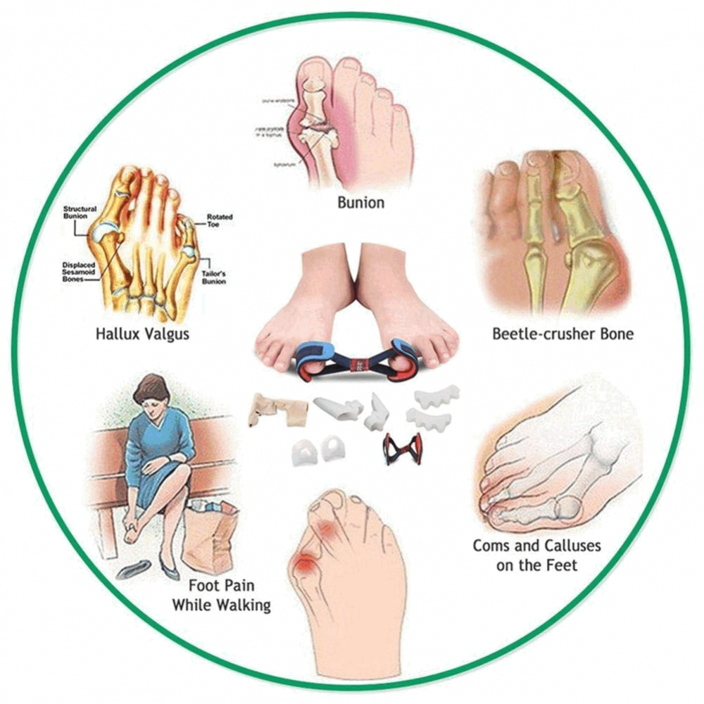 Set de orteze din silicon Numero Hallux Valgus, 9 piese [2]