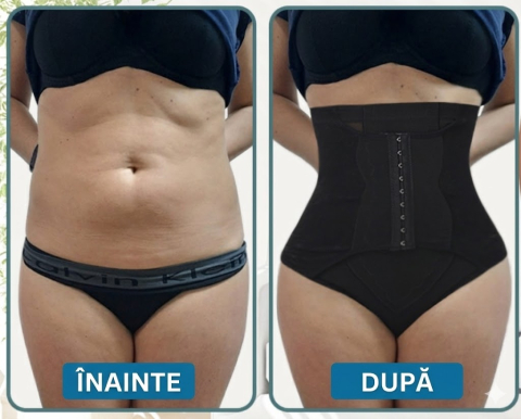 chilot-modelator-dama-figninget-talie-inalta-tanga-control-abdomen [6]