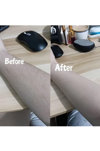 Dispozitiv de Epilare și Exfoliere, Fără Durere, Reutilizabil, culoare Aurie [4]