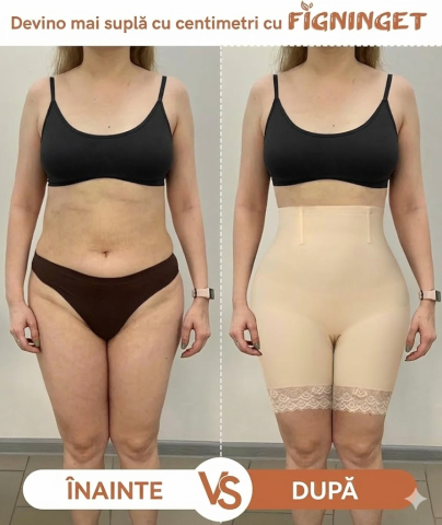 Pantaloni Modelatori Figninget pentru Femei – Short Shapewear Talie Înaltă, Control Abdomen, Liftare Fese 3D, Dantelă Anti-Frecare, Culoare Negru – Mărimea M [6]