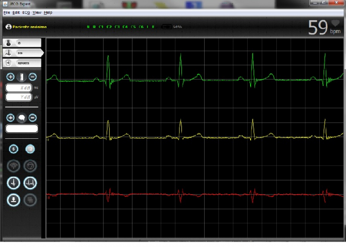 Aparat EKG ECG EXPERT - producator CSE Medical - inclusiv baterie, cablu USB cu incarcator, cablu pacient [5]