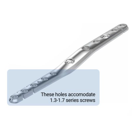 Mini 1.9-2.5 - Dorsal Carpus Panarthrodesis Plate Mini/Micro