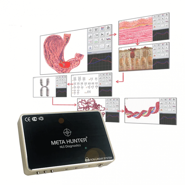 Aparat scanare biorezonanta Meta Hunter 4025 NLS, diagnosticare si terapie, versiune 2025 [6]