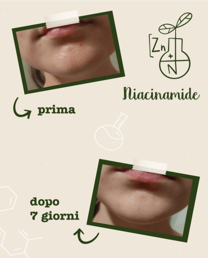 Activ pur cu Niacinamide si Zinc, 30 ml [7]