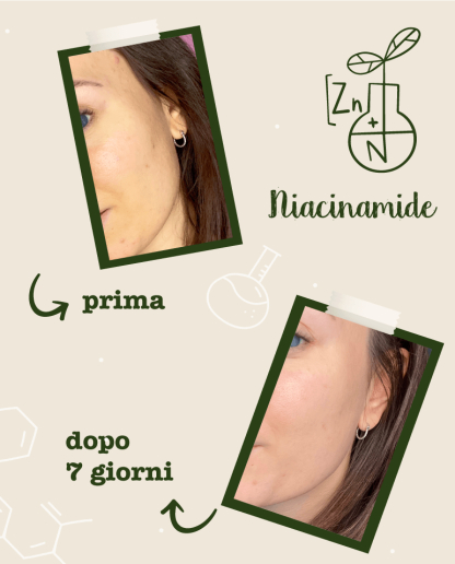 Activ pur cu Niacinamide si Zinc, 30 ml [5]
