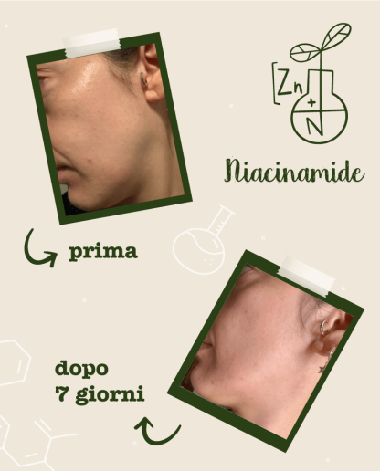 Activ pur cu Niacinamide si Zinc, 30 ml [4]
