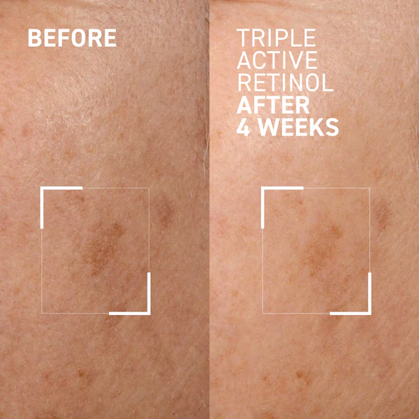 Crema de noapte cu retinol Bright This Way Triple Active Retinol, 30 ml, Dr. Brandt [3]