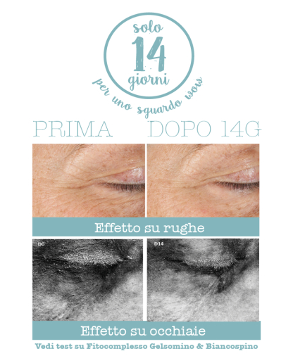 Crema pentru conturul ochilor 3 in 1 , 15 ml [3]