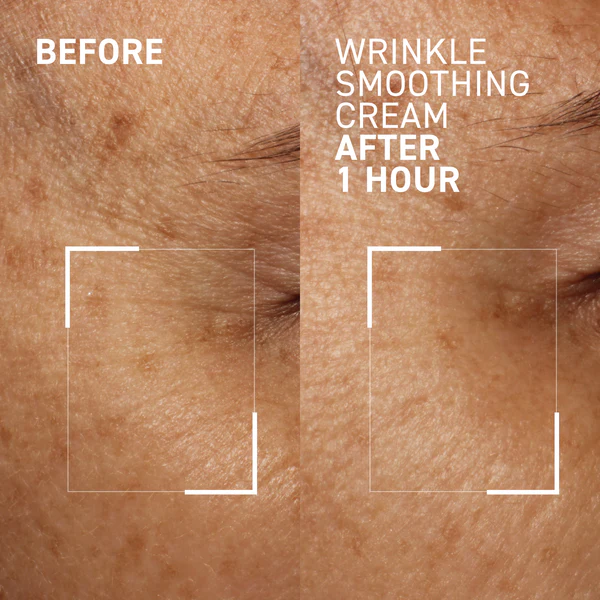 Crema pentru netezirea ridurilor Needles No More Wrinkle Smoothing Cream, 15 ml, Dr. Brandt [3]